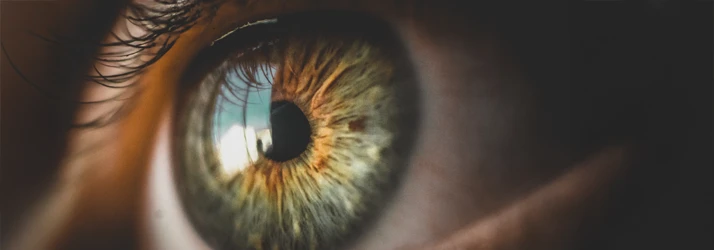 FC – Cataract Surgery at Dr. Obermark Eye Health Care